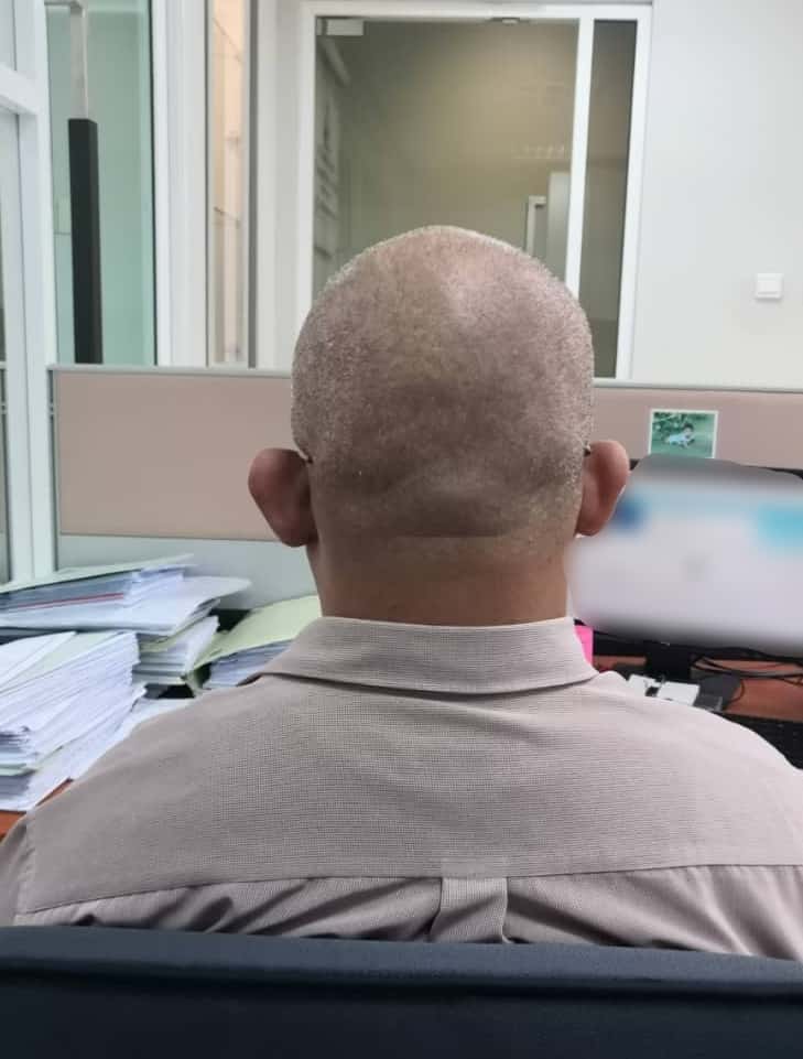Gara-Gara Tak Tahan Suami Berkepala Botak, Isteri Tergamak Buat Laporan Polis 2 Gara-Gara Tak Tahan Suami Berkepala Botak, Isteri Tergamak Buat Laporan Polis 2