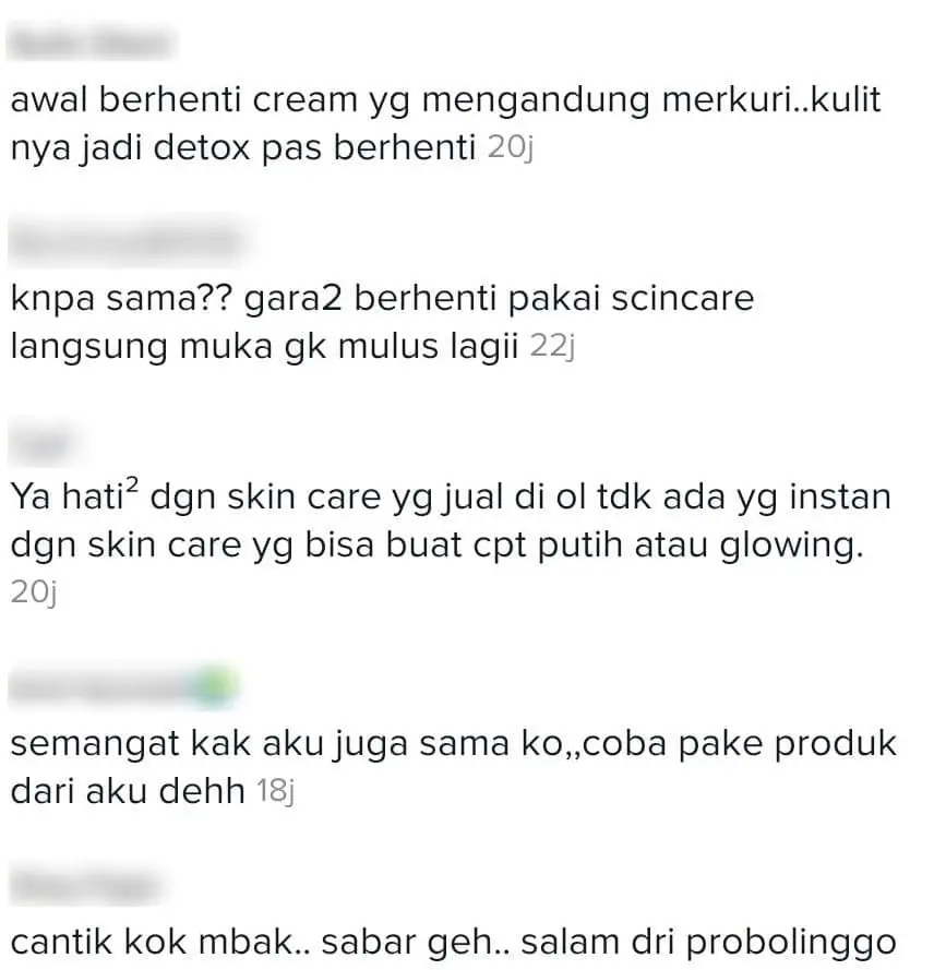 [VIDEO] Dulu Kulit Muka Cantik, Tapi Break-Out Teruk Lepas Salah Guna Skincare