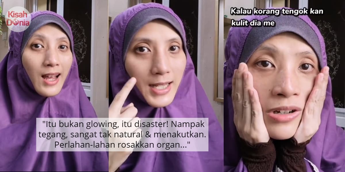 [VIDEO] Bangga Muka Glowing & Kulit Tegang, Wanita Ini Dedahkan Realiti Sebenar 9