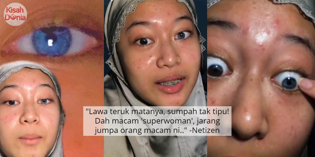 [VIDEO] Gadis Mata Biru Muak Asyik Ditegur -"Dik, Contact Lens Jatuh Sebelah.." 7