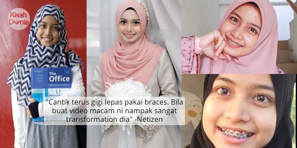 [VIDEO] Ajak BerTikTok, Ramai Terkejut Tahu Status Sebenar ‘Awek’ Pemuda Ini