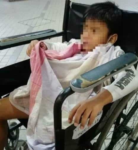 Klinik Cuai Punca Anak Alami Bengkak Teruk Lepas Khatan, Kulit Habis Dipotong 7 Klinik Cuai Punca Anak Alami Bengkak Teruk Lepas Khatan, Kulit Habis Dipotong 7