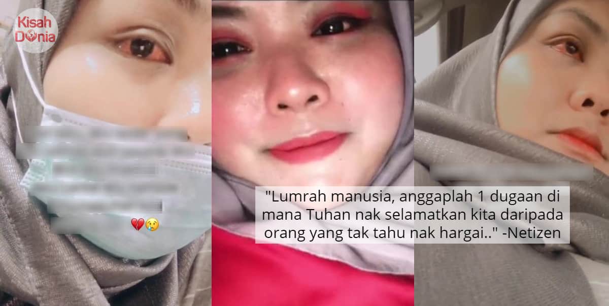 Ex Suruh Pakai Contact Lens Tiap Kali Dating, Gadis Tanggung Derita Radang Mata 10