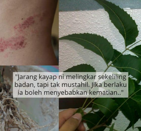 Gerunnya Jika Kayap Ular Bersambung, Rupanya Ada Ikhtiar Lain Untuk Merawat 9 Gerunnya Jika Kayap Ular Bersambung, Rupanya Ada Ikhtiar Lain Untuk Merawat 9