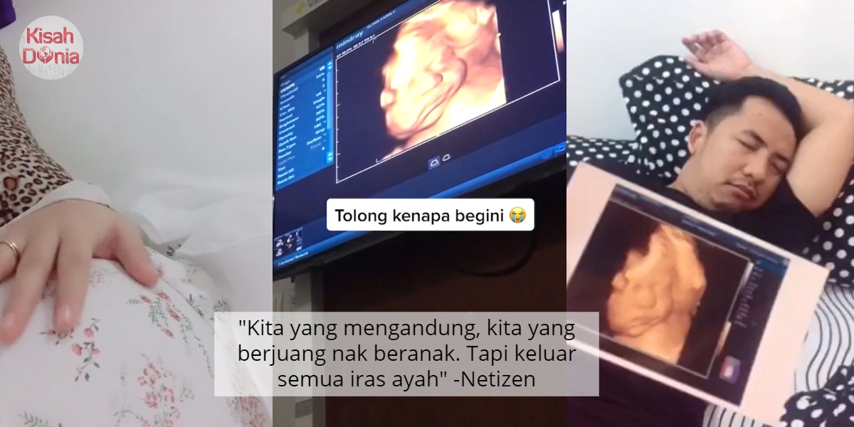 [VIDEO] Belum Keluar Dah Sama Gaya Ayah, Ibu Pasrah Tengok Gambar Scan Baby 6