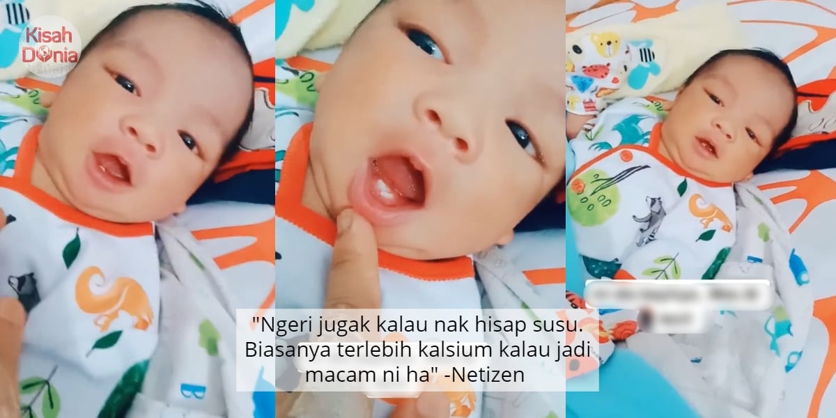 [VIDEO] Bayi Baru Lahir Tapi Dah Tumbuh Gigi, Perlu Cabut Atau Biarkan Saja? 7