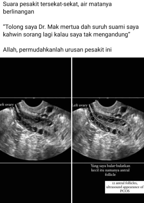 "Tolong Saya Doktor, Mak Mertua Suruh Suami Kahwin Sorang Lagi Kalau Tak Hamil" 6