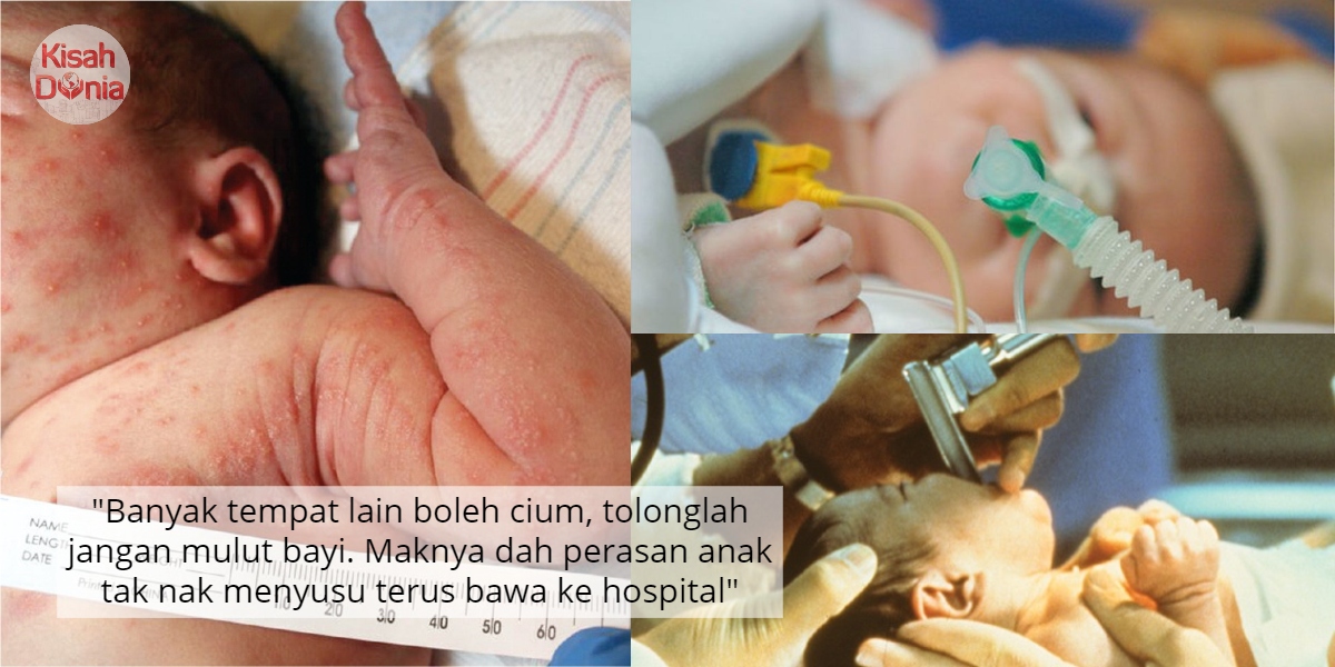 Baru 2 Jam Mulut Dikucup Ahli Keluarga, Bayi 18 Hari Lembik Organ Tak Berfungsi 10