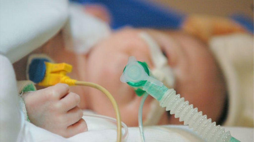 Baru 2 Jam Mulut Dikucup Ahli Keluarga, Bayi 18 Hari Lembik Organ Tak Berfungsi 6