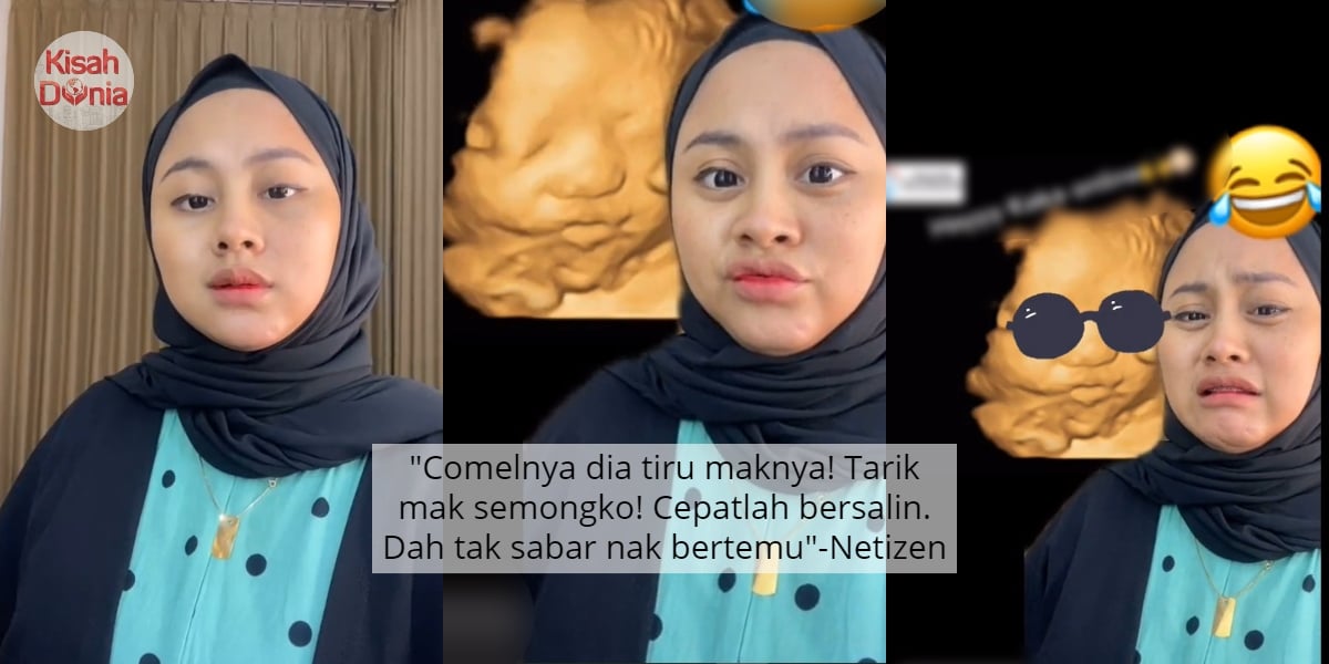 [VIDEO] Ditegur Jangan Buat Muka Masa Hamil, Ibu Terkejut Tengok Foto Scan Anak 8