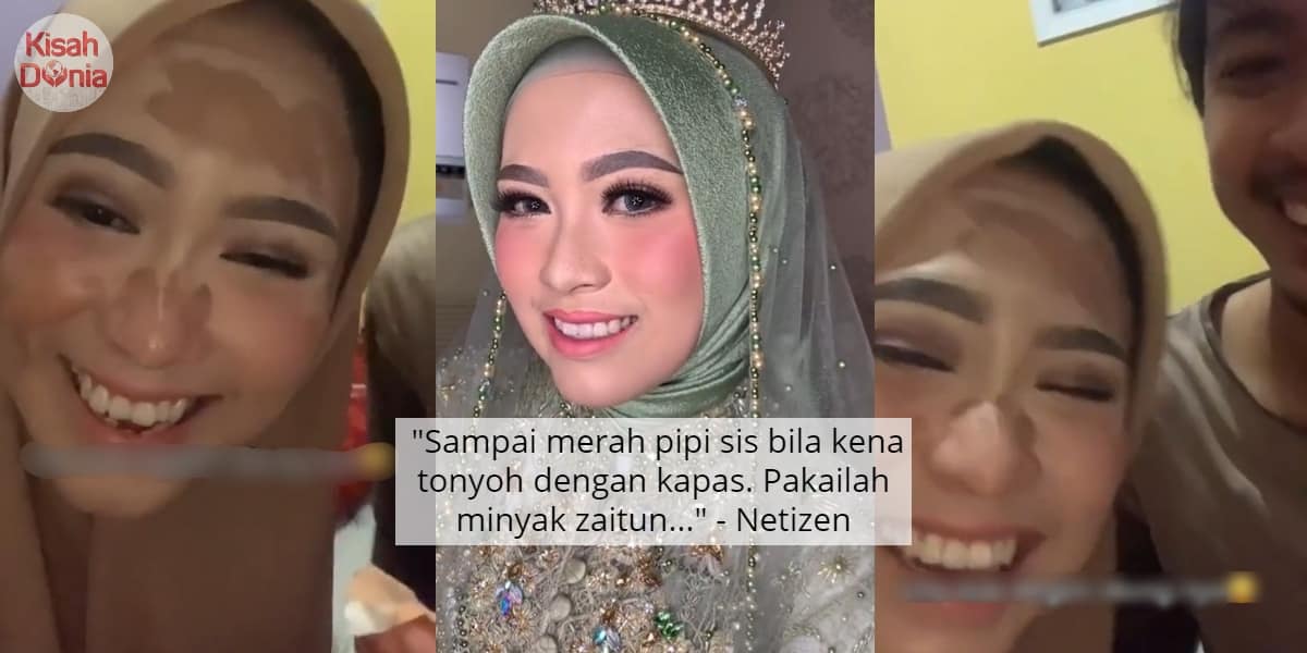 Suami Remove Makeup Isteri Lepas Wedding, Berdekah Warna Kulit Sebenar Kantoi 4
