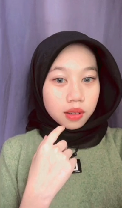 Mata Gadis Terpaksa 'Dikorek', Rosak Dijangkiti Kuman 'Ketagih' Contact Lens 2