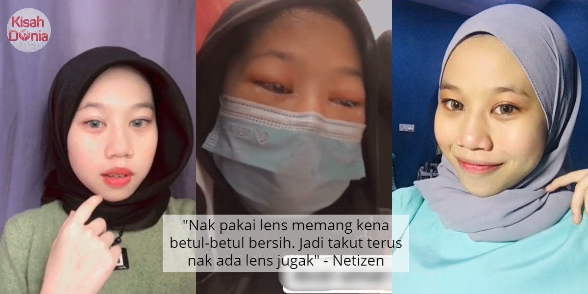 Mata Gadis Terpaksa 'Dikorek', Rosak Dijangkiti Kuman 'Ketagih' Contact Lens 12