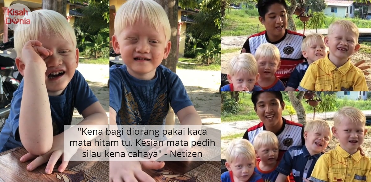 [VIDEO] Ramai Sangka Mat Saleh Celup, Rupa-Rupanya 'Pakej' 4 Beradik Albino 29