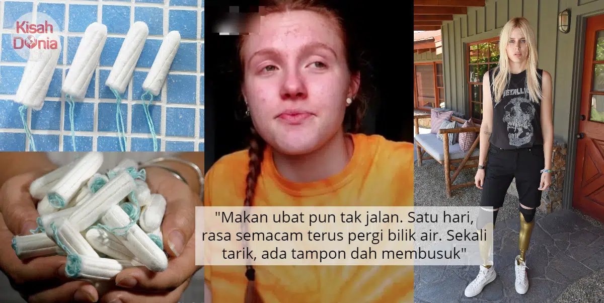 Tampon Tertinggal Sebulan Dalam Rahim, Gadis Alami TTS-Kaki Terpaksa Dibuang 44