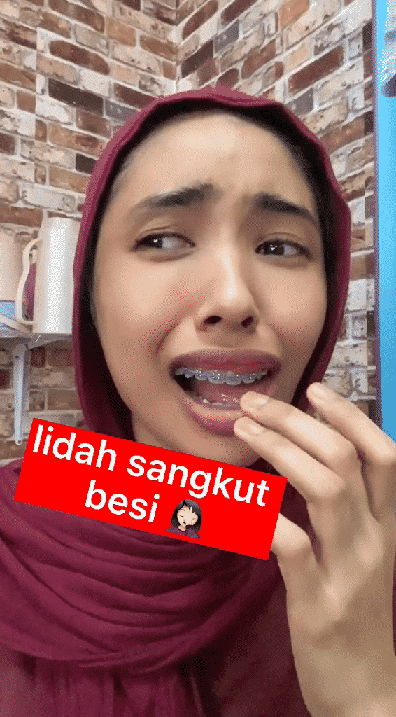 Lidah Tersangkut Braces Waktu Makan, Gadis Panik -“Ada Yang Nak Tolong Welding”