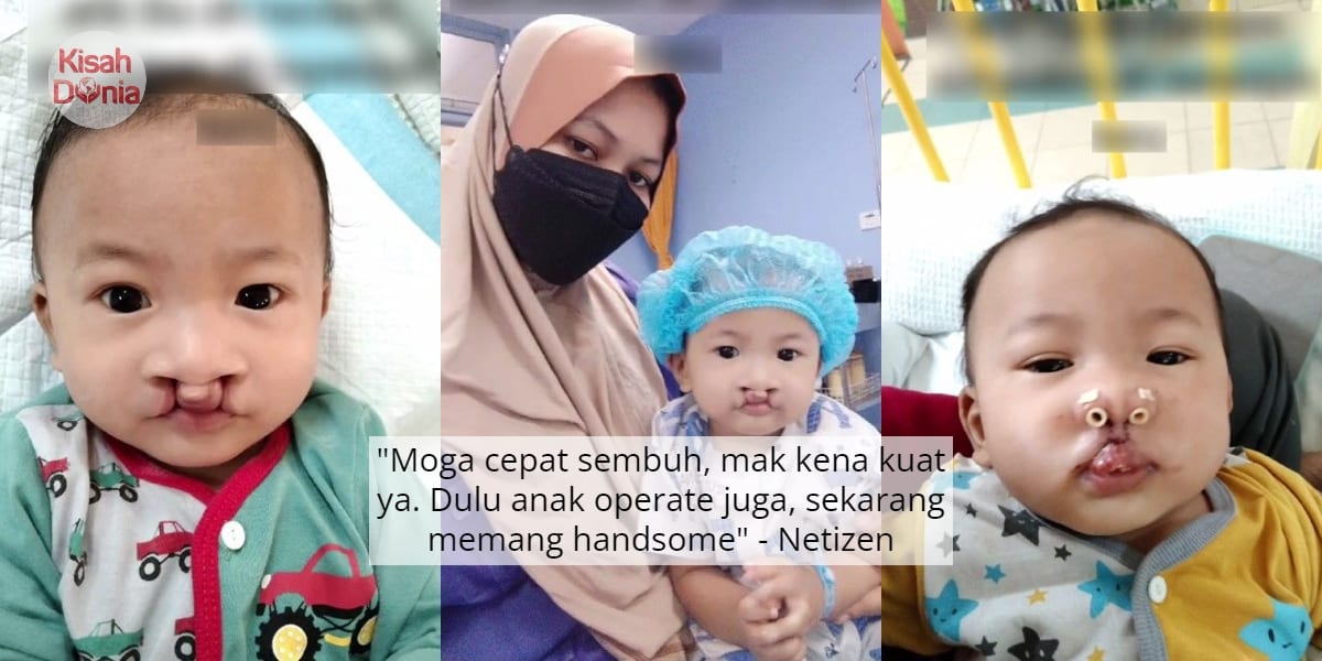 [VIDEO] Banyak Belajar Erti Sabar, Ibu Syukur Anak Sumbing Kini Makin Handsome