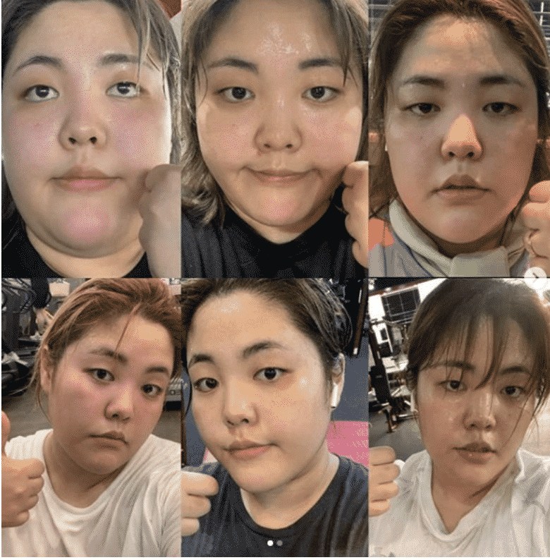 Dulu Obesiti Akibat Mukbang, Gadis Korea Kini Terlalu Slim & Wajah Nampak Lain 8