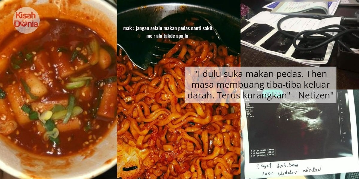 Mak Dah Warning, Gadis 'Hantu' Makanan Pedas Pasrah Kini Tanggung Barah Ovari 5