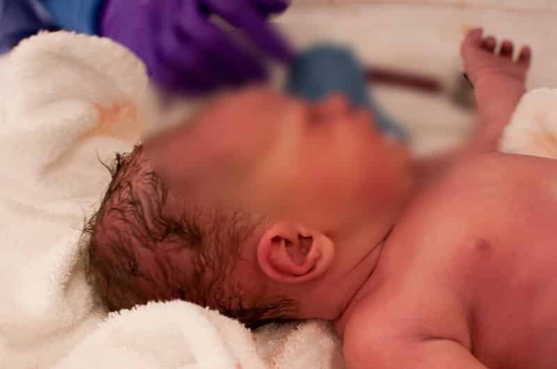Kepala Bayi Baru Lahir Jadi Lonjong Lepas Vakum, Doktor Pesan Jangan Main Tekan 2