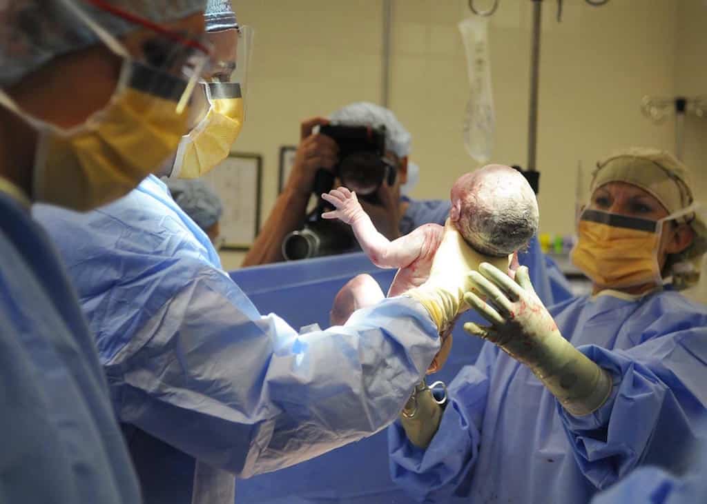 Kepala Bayi Baru Lahir Jadi Lonjong Lepas Vakum, Doktor Pesan Jangan Main Tekan 3