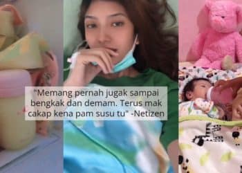 Kepala Bayi Baru Lahir Jadi Lonjong Lepas Vakum, Doktor Pesan Jangan Main Tekan