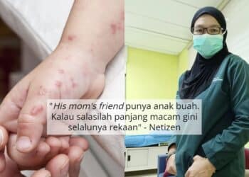 Monkeypox Dah Muncul Di Malaysia? Doktor Tegur Jangan Cetus Panik Keterlaluan 1