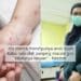 Monkeypox Dah Muncul Di Malaysia? Doktor Tegur Jangan Cetus Panik Keterlaluan 5