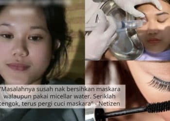 Selalu Malas Bersihkan Maskara Lepas Pakai, Gadis Serik Bila Mata Jadi Gatal 6