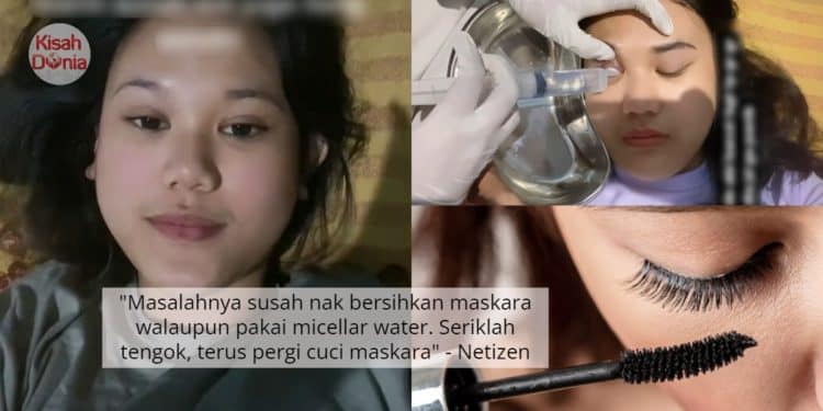 Selalu Malas Bersihkan Maskara Lepas Pakai, Gadis Serik Bila Mata Jadi Gatal 1