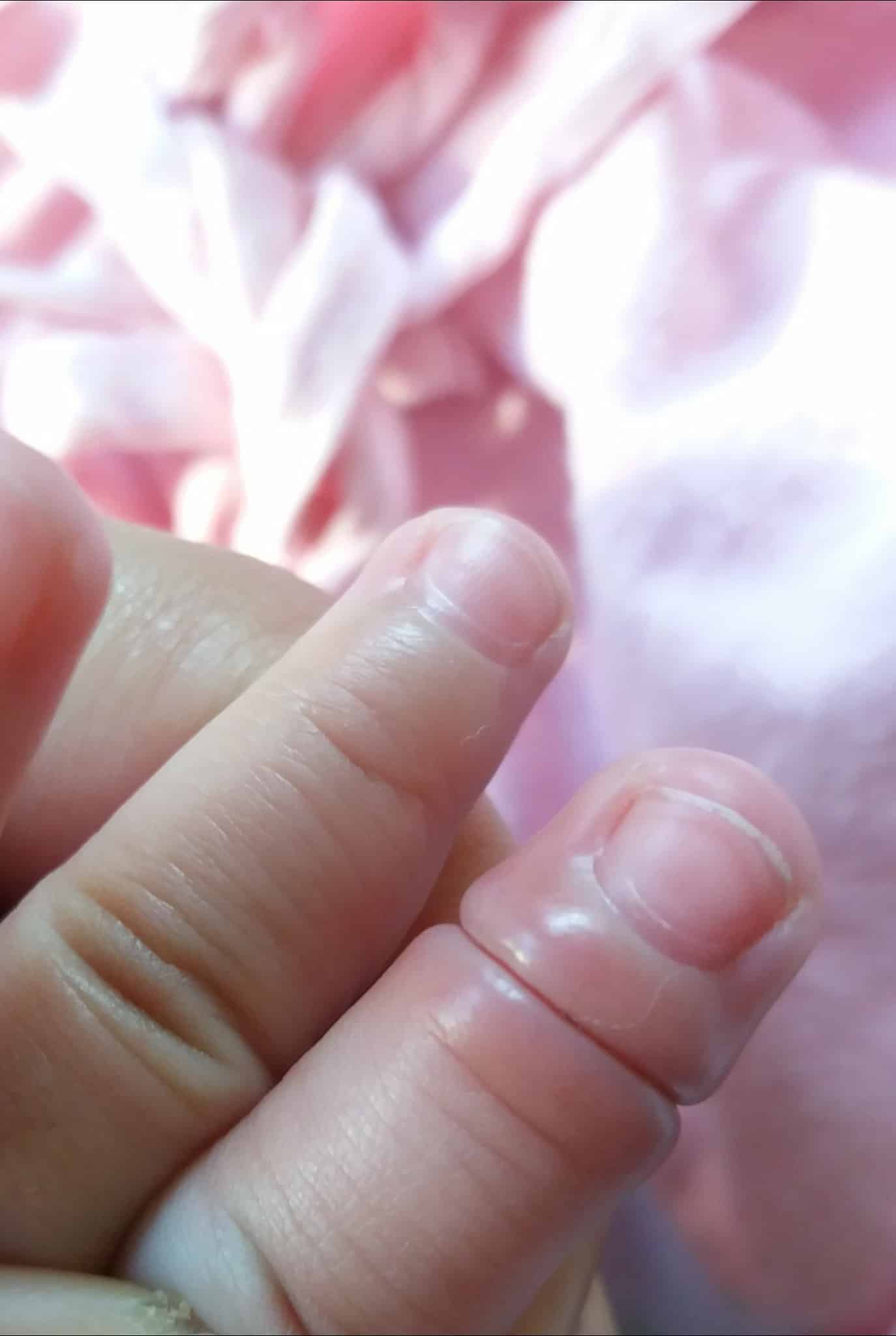 Bayi Tak Nangis Walaupun Jari Lama Terlilit, Waspada Ibu Yang Ada Rambut Gugur 5