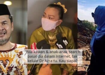 Bayi Tak Nangis Walaupun Jari Lama Terlilit, Waspada Ibu Yang Ada Rambut Gugur