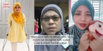 Jangan Teran Macam Berak, Salah Teknik Punca Anak Lahir Kepala ‘Senget’ Sebelah