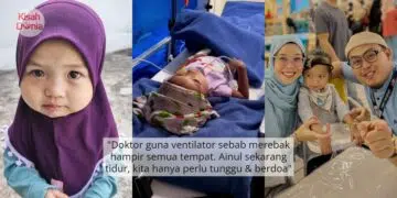 Jangan Teran Macam Berak, Salah Teknik Punca Anak Lahir Kepala ‘Senget’ Sebelah
