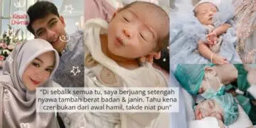 Jangan Teran Macam Berak, Salah Teknik Punca Anak Lahir Kepala ‘Senget’ Sebelah