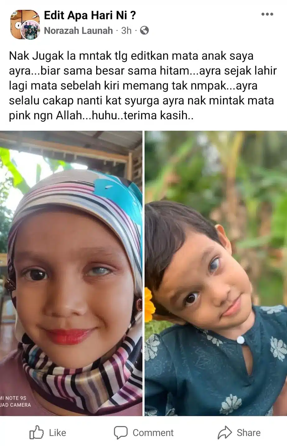 Lahir Tanpa Mata Kiri, Ibu Minta Netizen Edit Foto Anak Agar Terlihat Sempurna