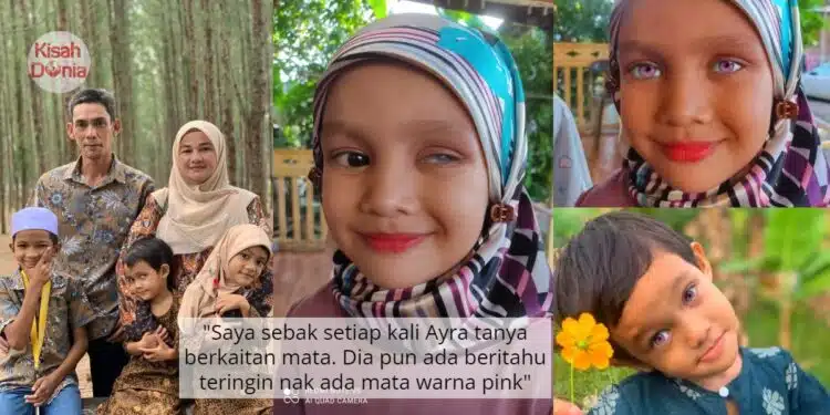 Lahir Tanpa Mata Kiri, Ibu Minta Netizen Edit Foto Anak Agar Terlihat Sempurna