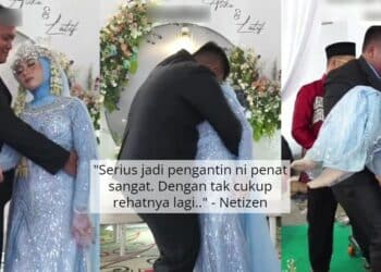 Bengkak Lepas Rawatan ‘Sulam Bibir’, Wanita Ditegur Suami- “Azab Tak Syukuri..”