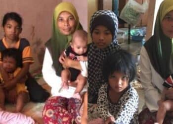 Cikgu Rakus Gigit Bibir Anak Hingga Trauma, Ibu Tegas Heret Isu Ke Mahkamah