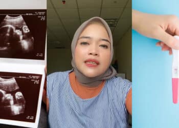 Tergelincir Saat Dukung Anak, Wanita Terkujat Kena Sawan Kepala Terhantuk Jalan