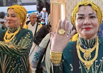 Cikgu Rakus Gigit Bibir Anak Hingga Trauma, Ibu Tegas Heret Isu Ke Mahkamah