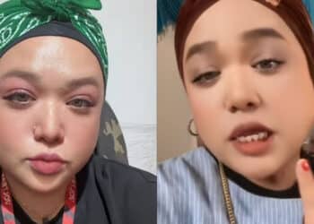 [JOHOR] Wanita ‘Tewas’ Terima Rawatan Besarkan Payudara, Pelaku Cuba Mengelak