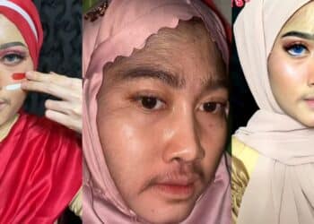 Setahun Lepas Berhenti Pakai Produk Merkuri, Wajah Wanita Bertukar Kehitaman