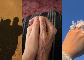 Setahun Lepas Berhenti Pakai Produk Merkuri, Wajah Wanita Bertukar Kehitaman