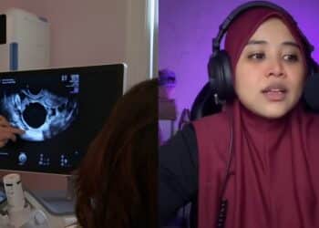 Ajak Tidur Rumah Setiap Kali BFF Ada Masalah, Wanita Bercerai Suami Kena Caras