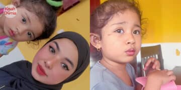 Netizen Terhibur, Gadis Patah Gigi Depan Gara – Gara Makan Tanghulu Viral