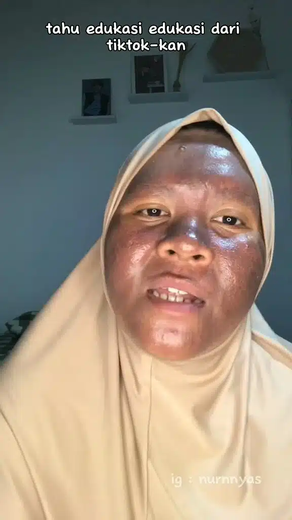 Setahun Lepas Berhenti Pakai Produk Merkuri, Wajah Wanita Bertukar Kehitaman