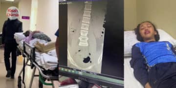 Bekas Czer Dikasari, Isteri Dianiaya Ex – Girlfriend Suami Yang Belum Move On