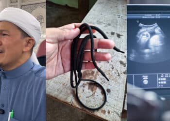 Achey Terharu Anak Isteri Hadiahkan Mercedes, Kemain Mencari Rupanya Plot Twist