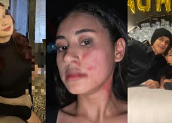 Achey Terharu Anak Isteri Hadiahkan Mercedes, Kemain Mencari Rupanya Plot Twist